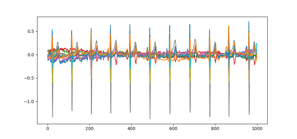 zufälliges EKG aus Datensatz geplottet